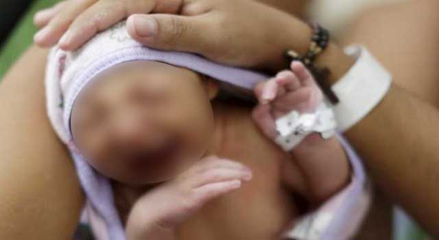 Langka! Tiga Bayi di Kutim Lahir Dengan Kelainan Otak