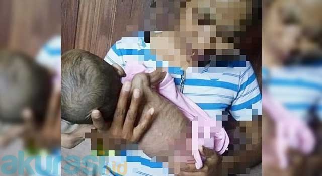 Berawal dari Pembengkakan, Bayi Bernama Dilson Dinyatakan Mengidap Gizi Buruk